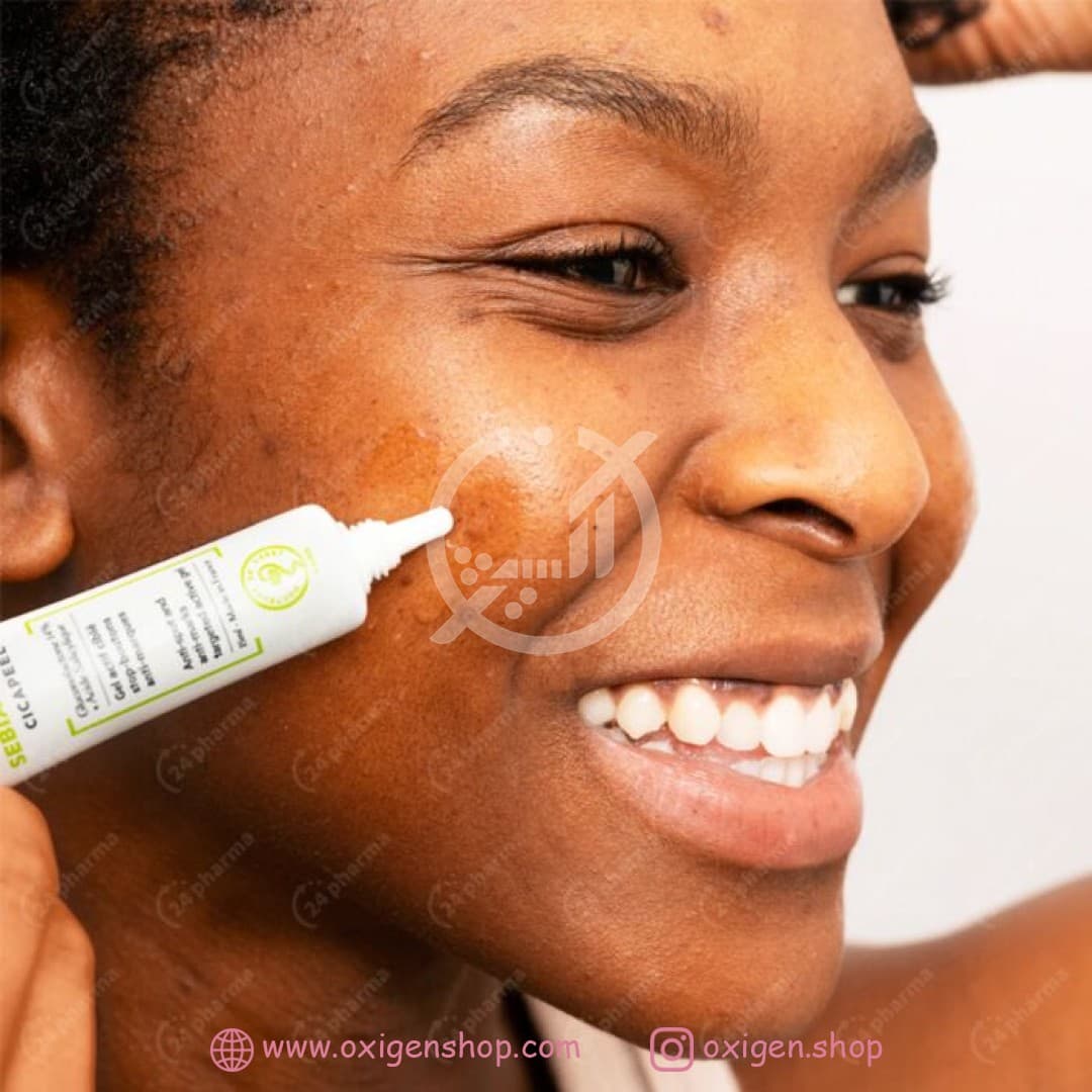 ژل ضد جوش اس وی آر ژل ضد جوش اس وی آر