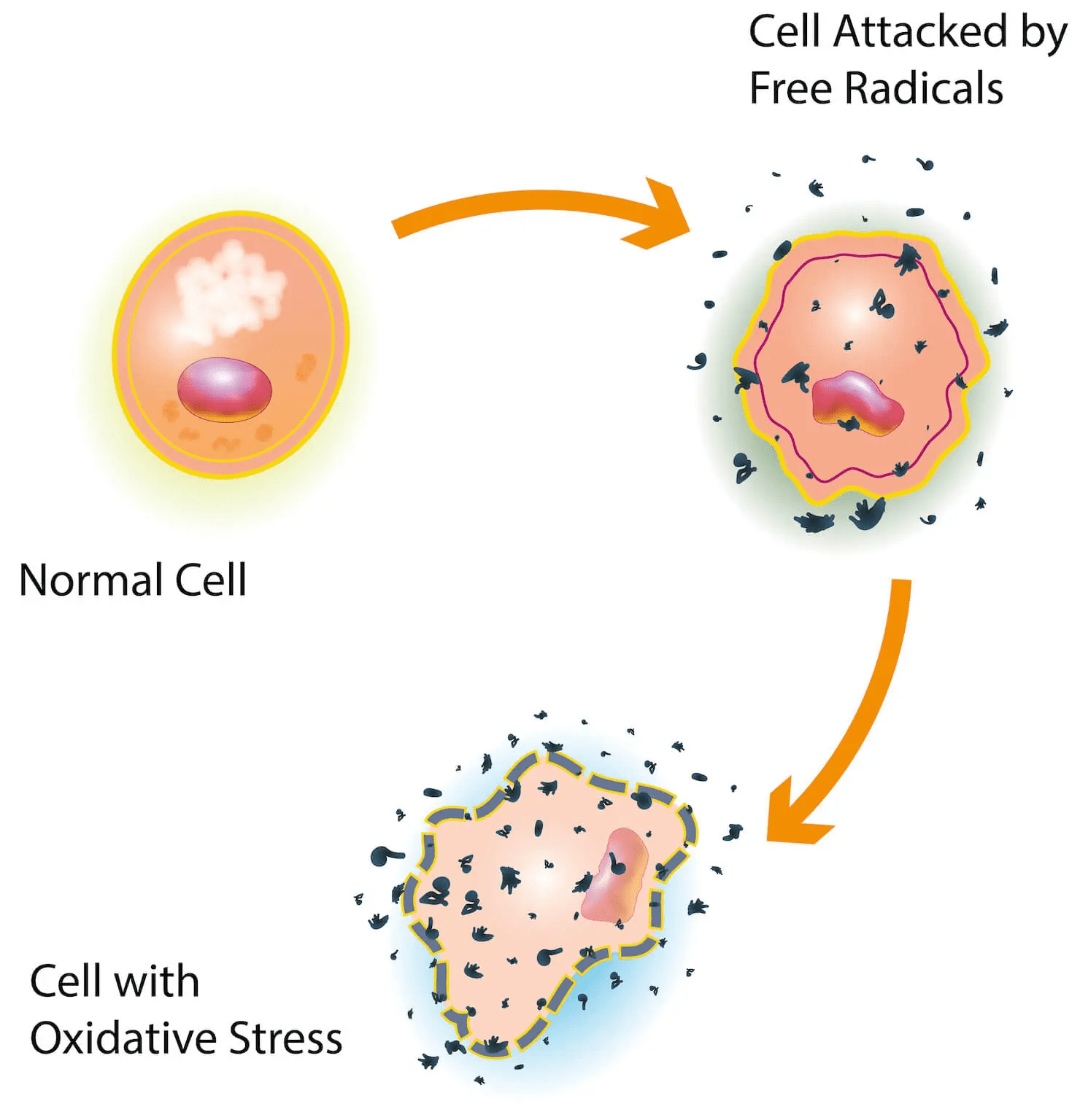 تبدیل سلول نرمال به سلولی که مورد حمله رادیکال های آزاد قرار گرفته	